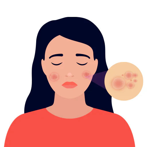 Atopic Skin – Raf Pharmacy